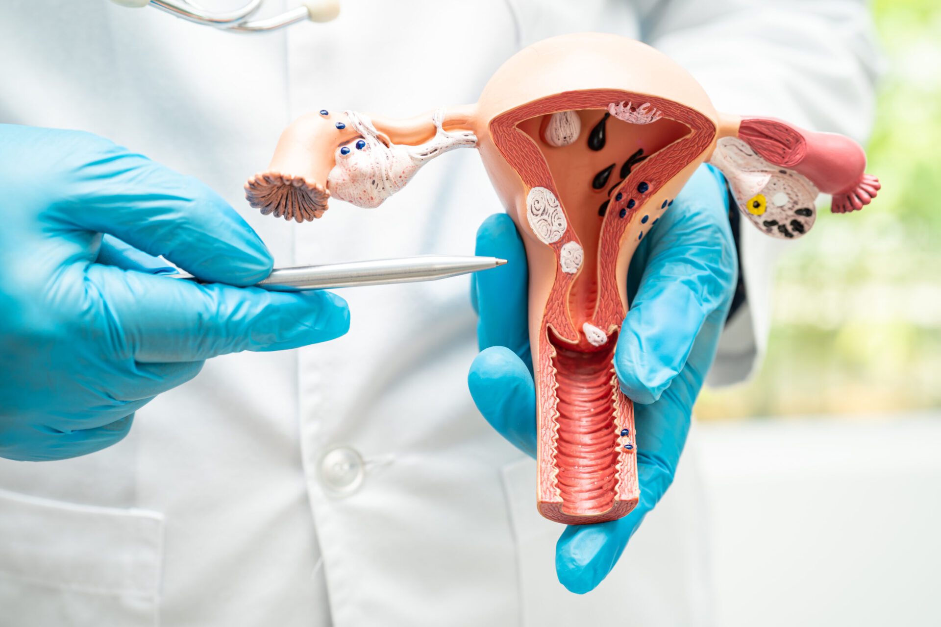 Uterus, doctor holding anatomy model for study diagnosis and tre Happy female doctor at office with patient